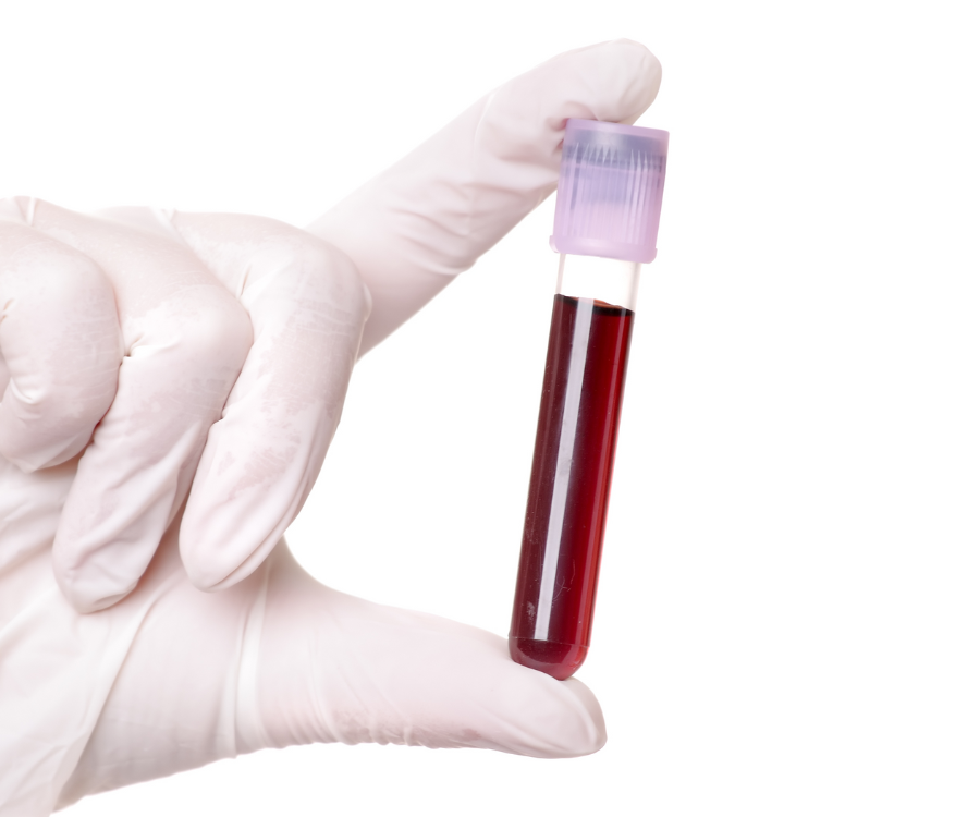 How Routine Blood Work Saves Your Health.